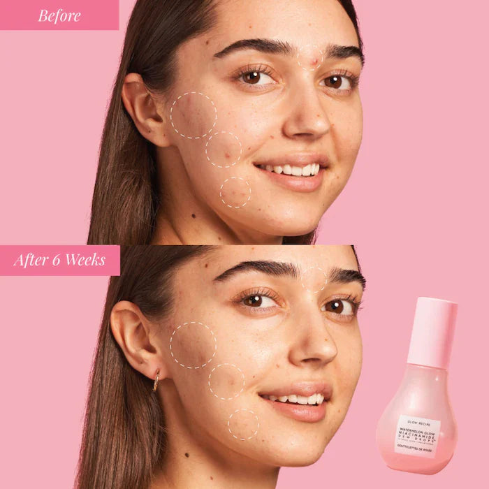 Watermelon Dew Drops Serum - Summit Beauty